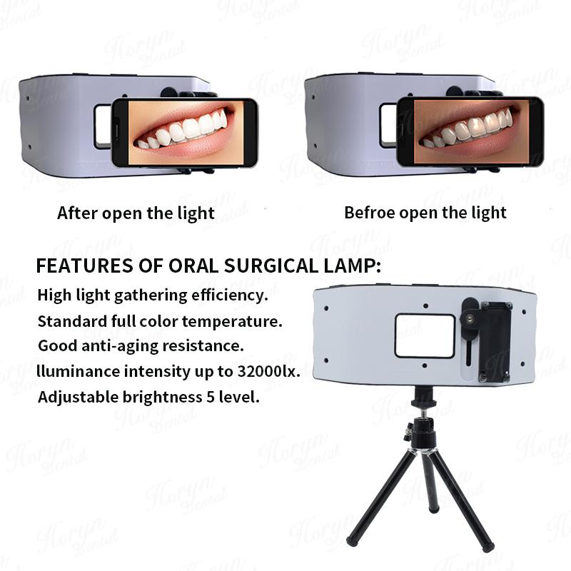 Dental Flash Light Sprzęt foto – Photography Lighting With Flash recenzja i cena